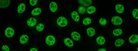 Immunofluorescence