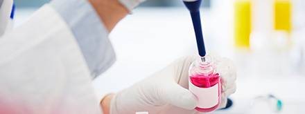 immunoblotting