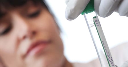 Updated Guidelines for Paraneoplastic Neurologic Syndromes