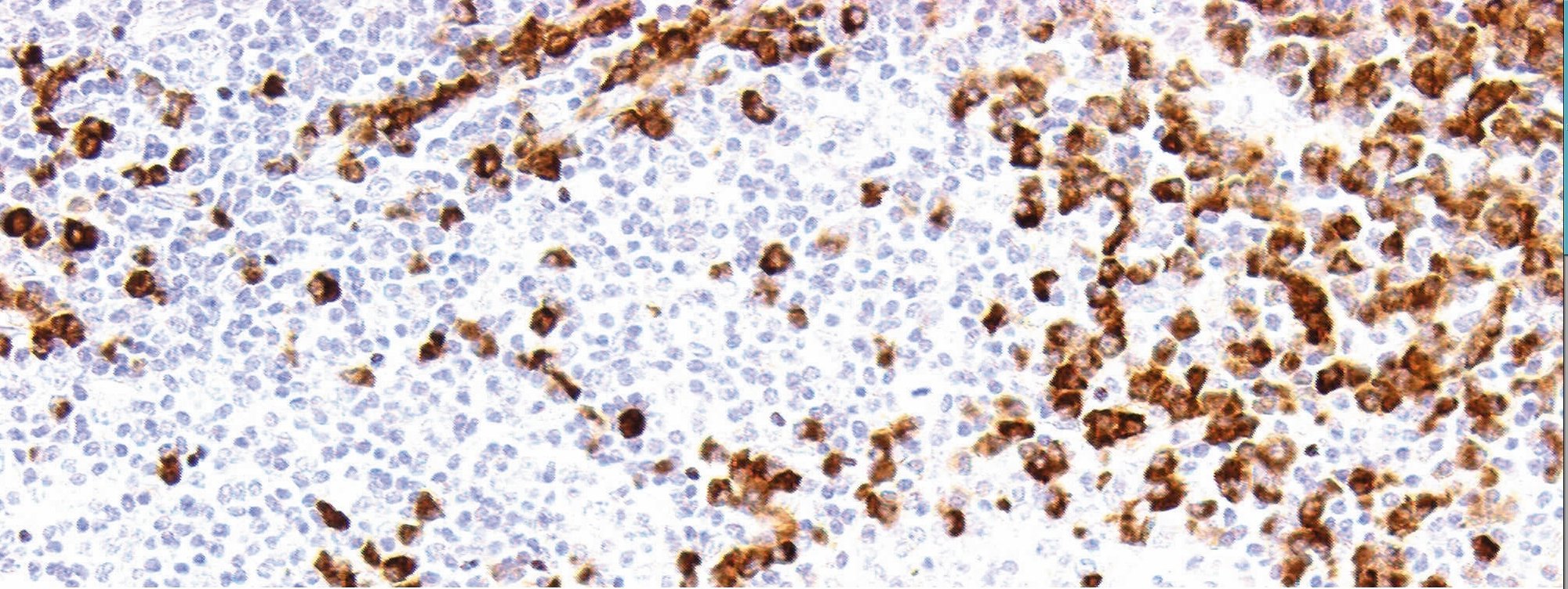 Immunohistochemical staining - IGG