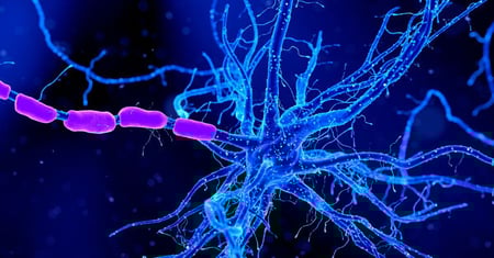 Understanding Neuromyelitis Optica Spectrum Disorder & Myelin Oligodendrocyte Glycoprotein Associated Disease