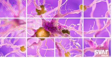 Wieslab now offers pTau-181 testing – a piece of the puzzle in the early diagnosis of Alzheimer's Disease