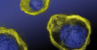 Svar-Life-Science-microscopic-view-of-green-blue-iLite-cell-based-reporter-gene-assay-lighting-up-1-1-1