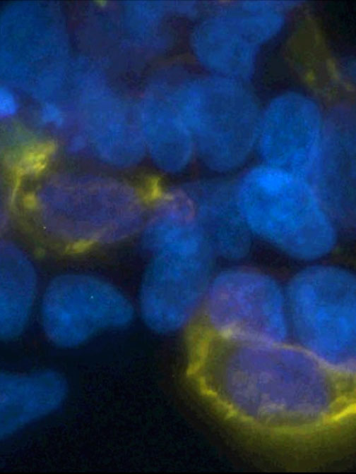 Assay-development-504x672